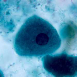 Figure C