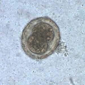 Figure B