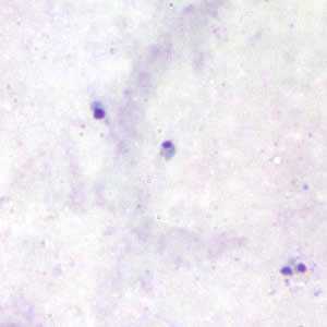Figure B
