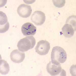 Figure B
