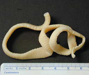 Figure B