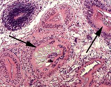 Figure C