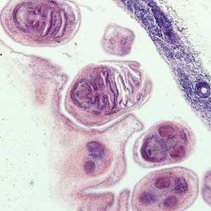 Figure B