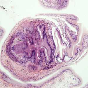 Figure C