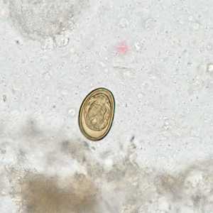 Figure D