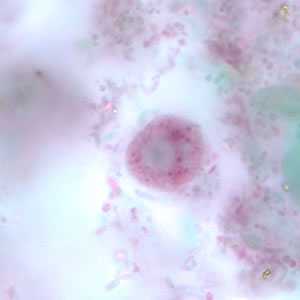 Figure C