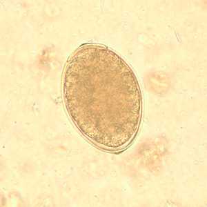 Figure C