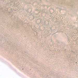Figure C