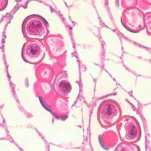 Figure C