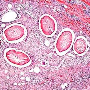 Figure C