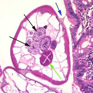 Figure B