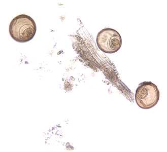 Figure C