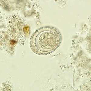 Figure C