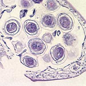 Figure B