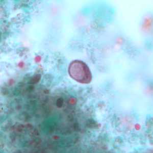 Case243_C