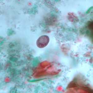 Case243_D