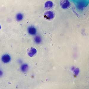 Case245_A