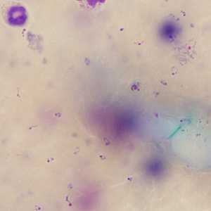 Case245_B