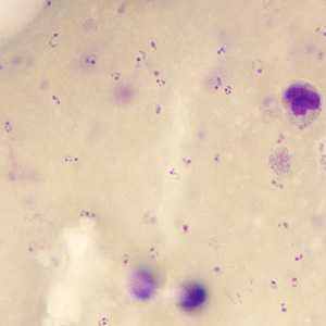 Case245_C