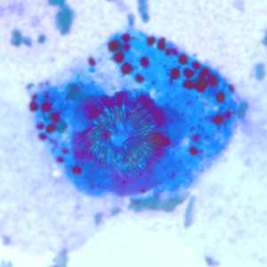 Case247_B