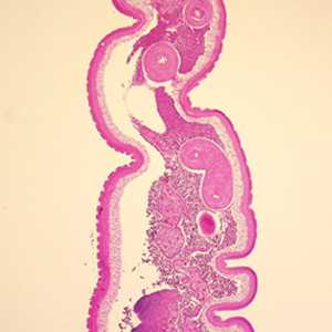 Case248_B