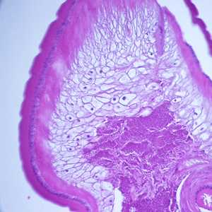 Case248_D