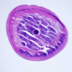 Case248_E