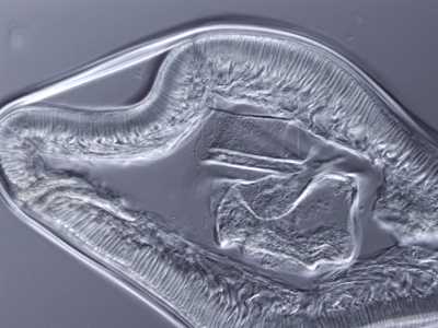 Case249_B
