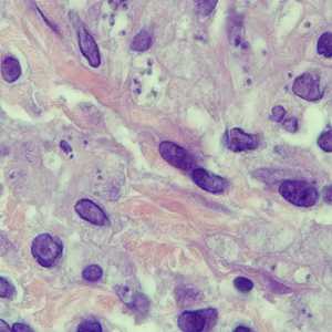 Case250_A