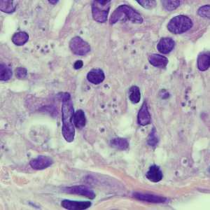 Case250_B