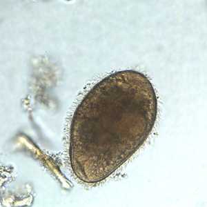 Case251_B