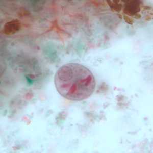 Case251_C