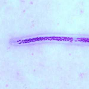 Case252_B