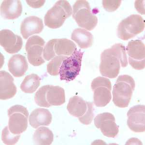 Case255_B