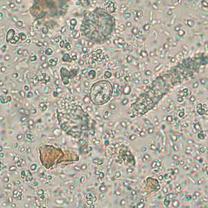 Case256_B