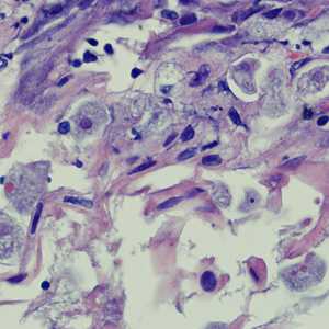 Case258_A