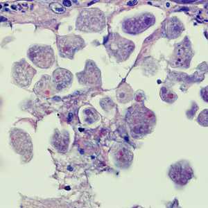 Case258_B