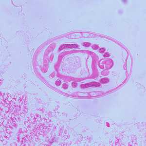 Case259_C