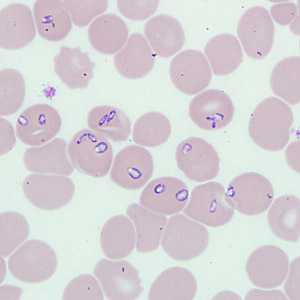 Case262_A