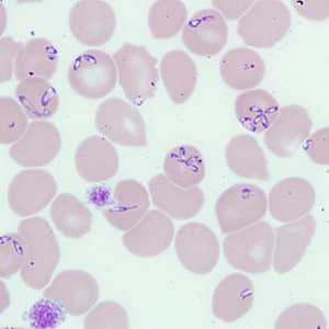 Case262_B