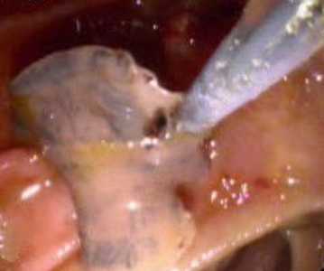 Case263_A