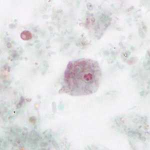 Case265_C
