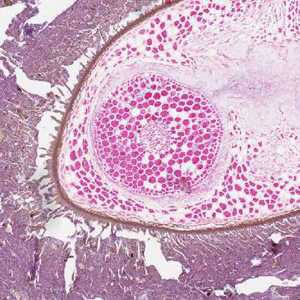 Case267_B