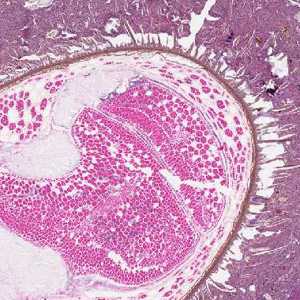 Case267_C