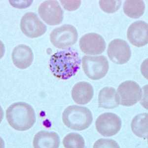 Case271_B