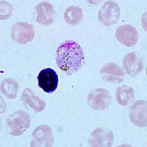 Case271_C