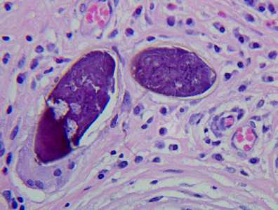 Case272_B