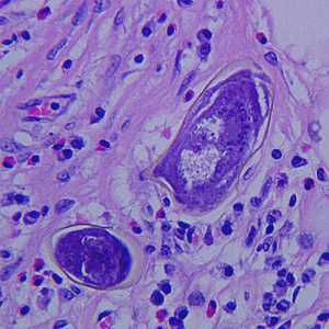 Case272_D