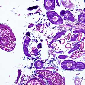 Case275_D