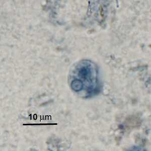 Case276_B